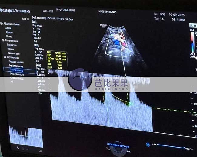 试管妈妈做四维彩超
