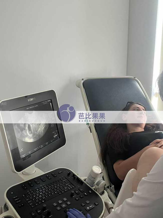 试管妈妈做B超