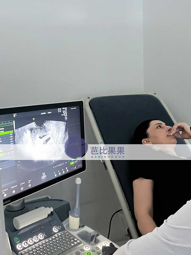 试管妈妈做B超