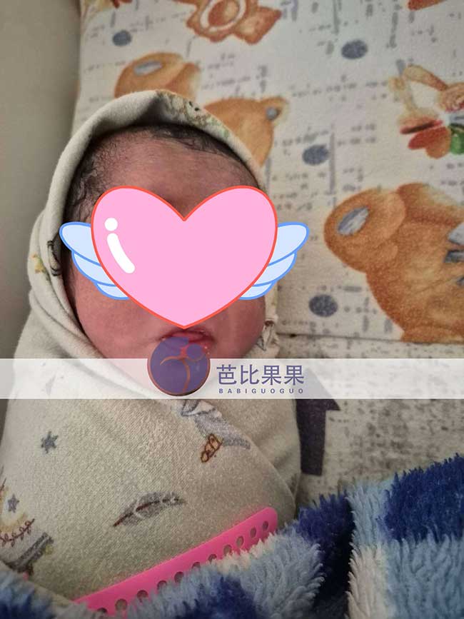 试管宝宝出生