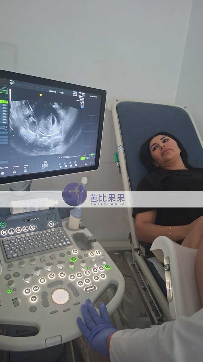 试管妈妈做B超