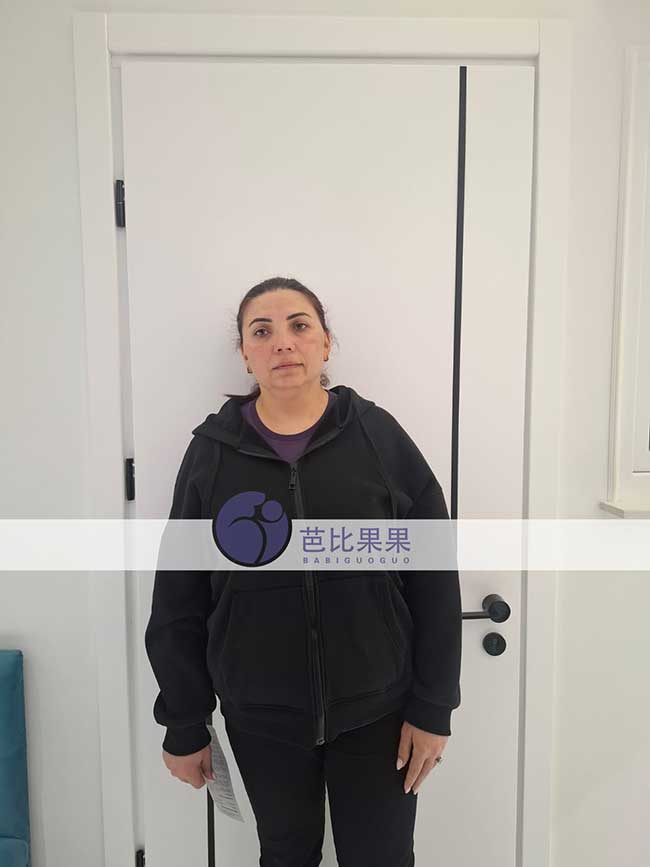 试管妈妈孕早期产检