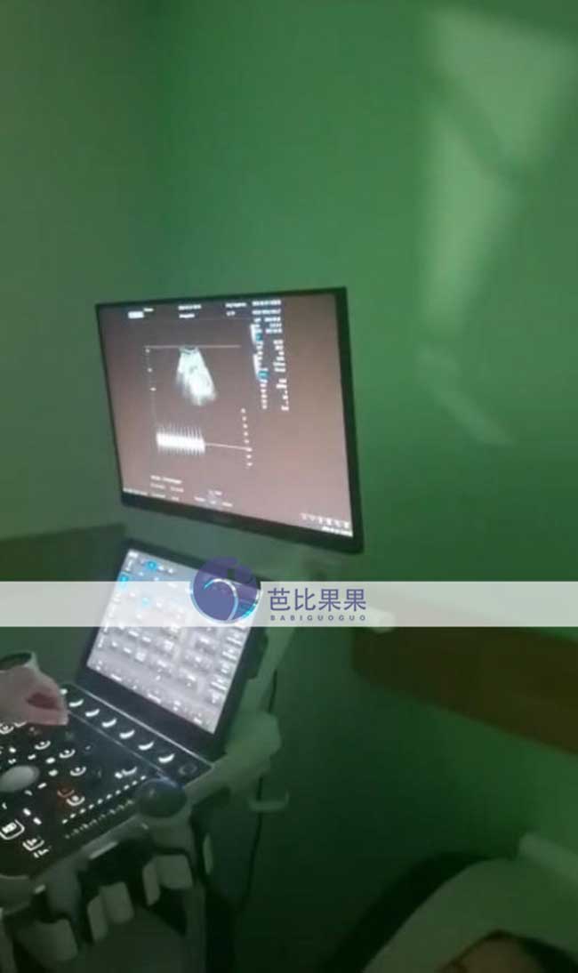 试管妈妈孕早期产检