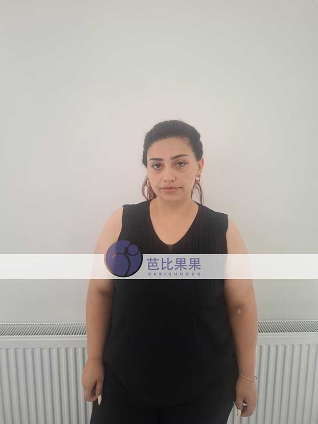 一份刚过NT关，一份迈入孕16周｜格鲁吉亚试管两个家庭的孕期记录
