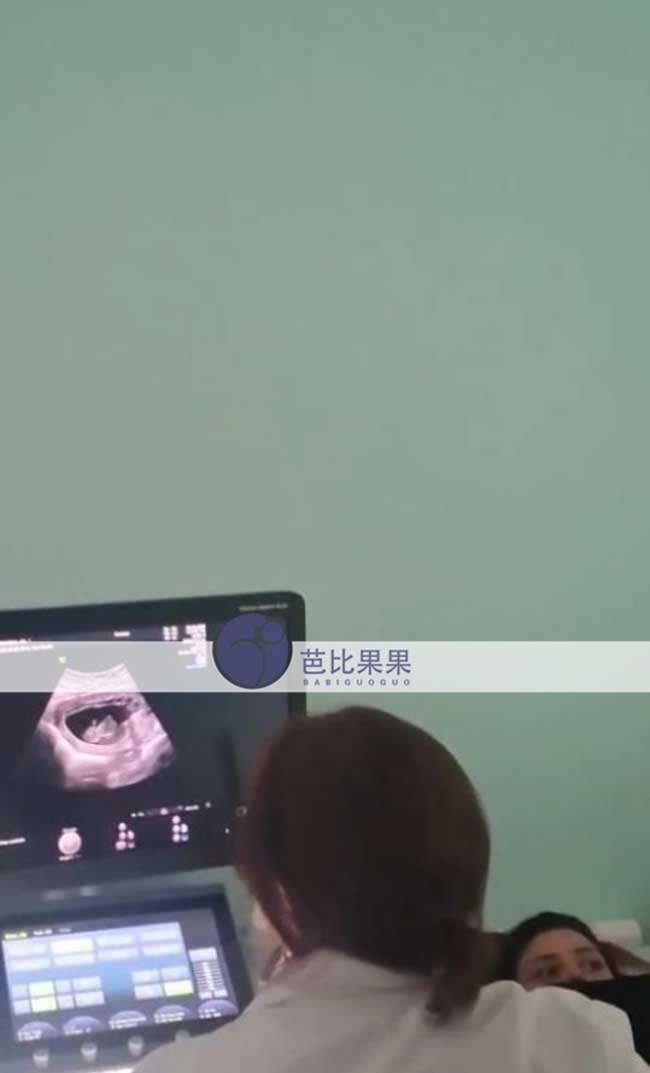 试管妈妈做产检