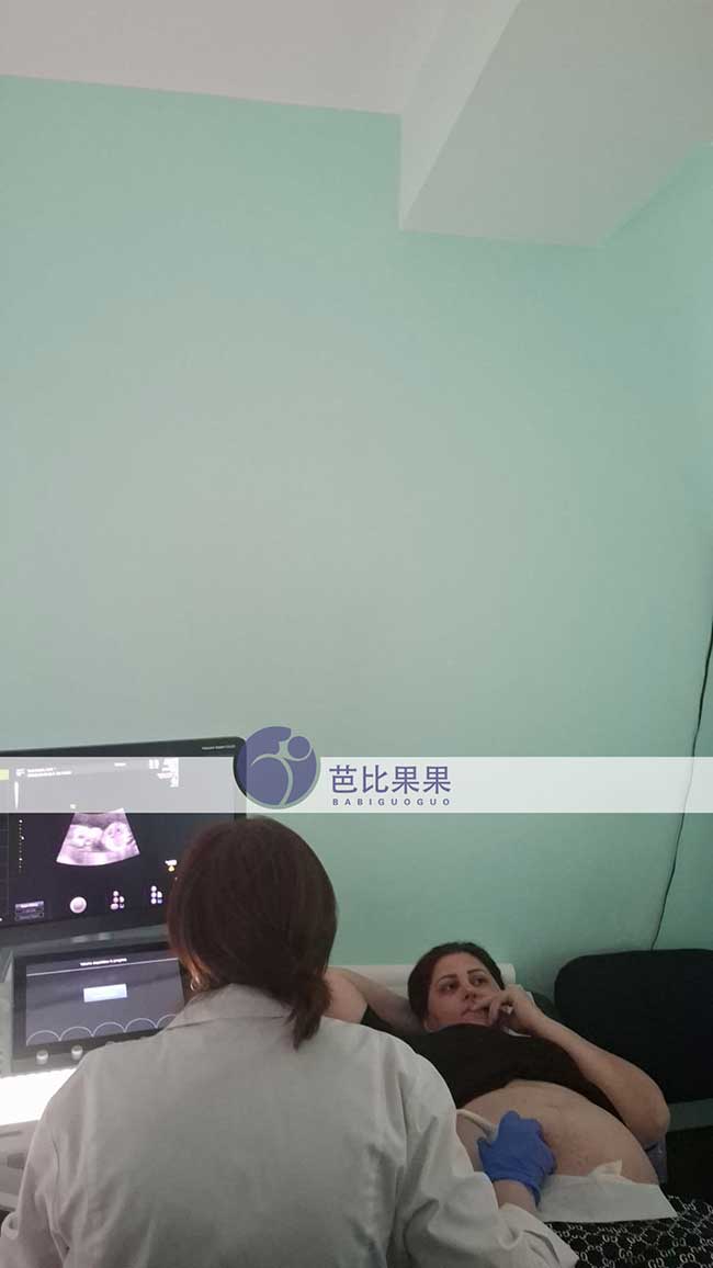 试管妈妈做产检