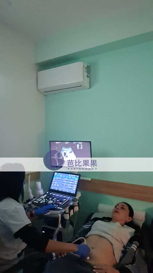 试管妈妈孕早期B超