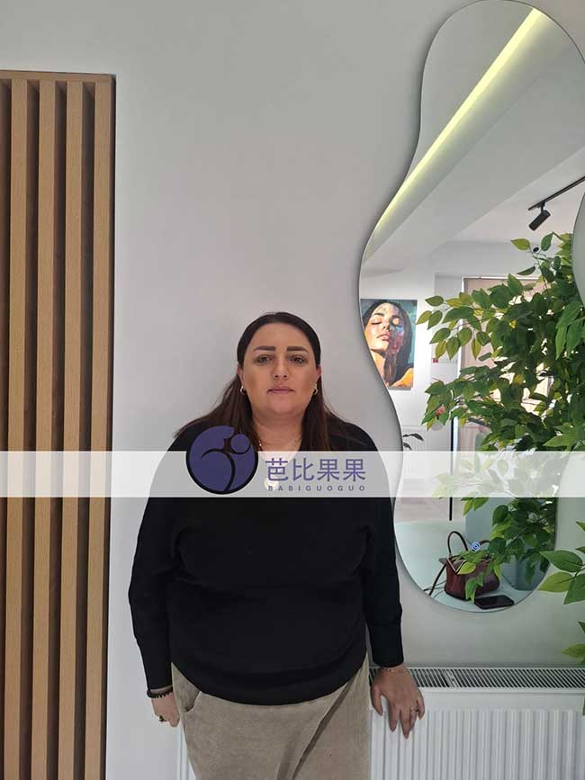 试管妈妈做B超