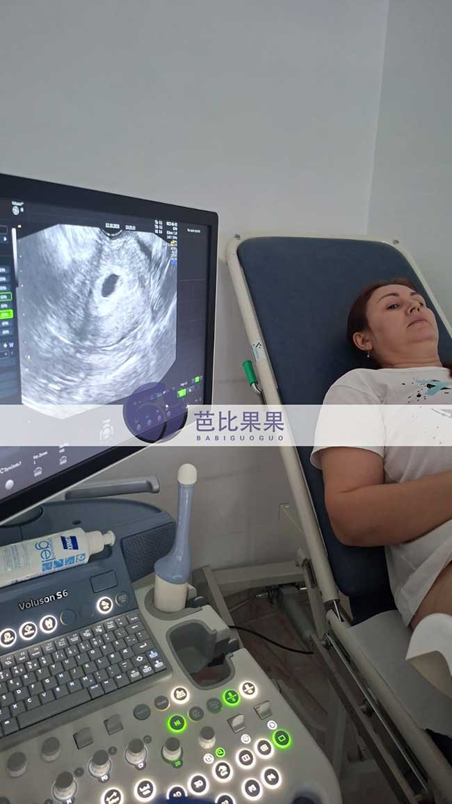 试管妈妈首次B超