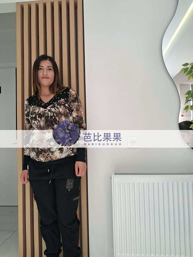 试管妈妈孕26周产检