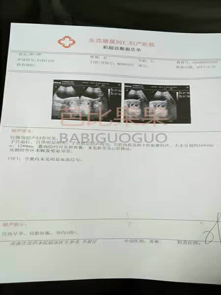 L美女的B超报告已经确定着床了双胞胎