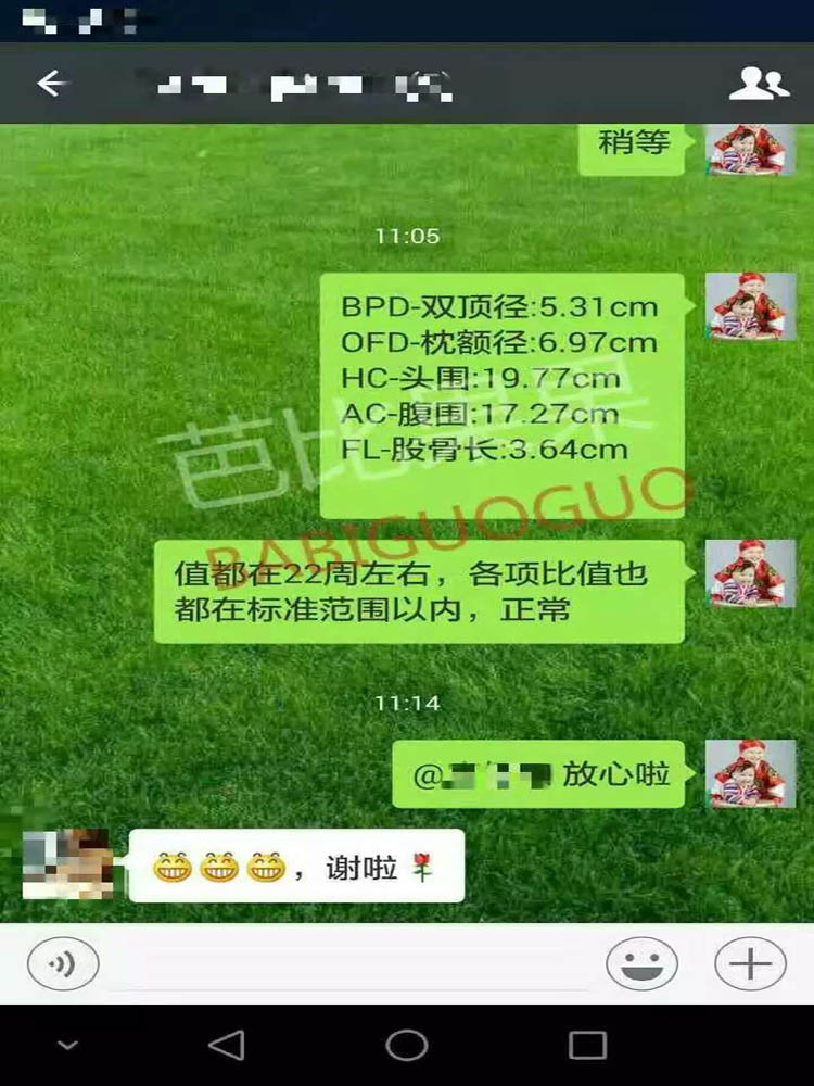 泰国同事发来了T女士SGM的B超报告