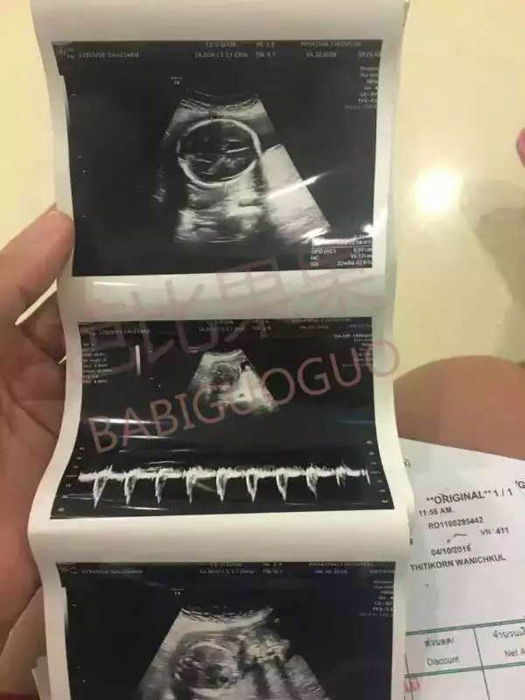 泰国试管婴儿 