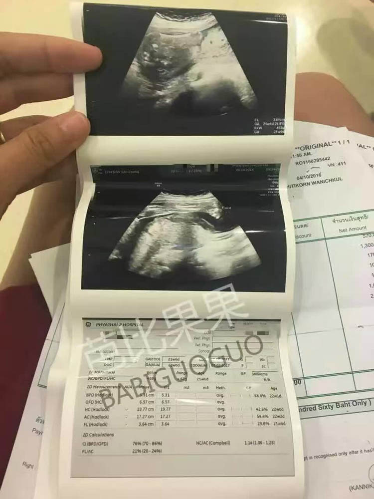 泰国试管婴儿 