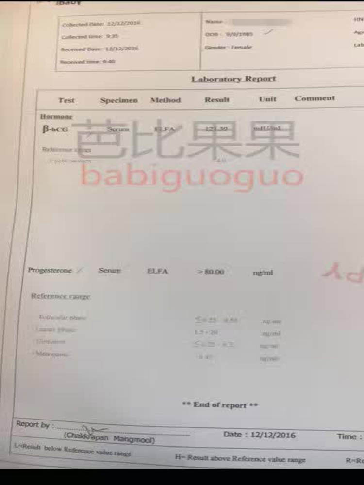 od+sgm两次移植成功，成为泰国的第一个sgm包成功套餐客户