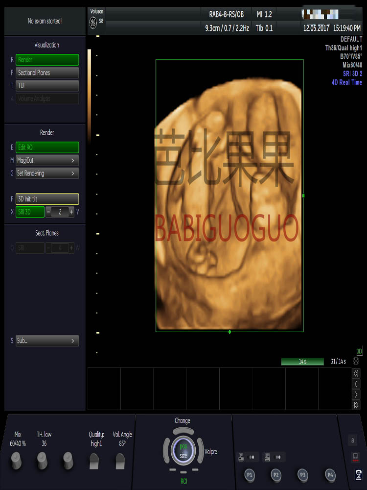 乌克兰代怀孕