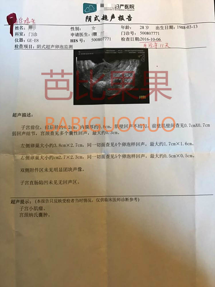 泰国试管婴儿成功移植报告图