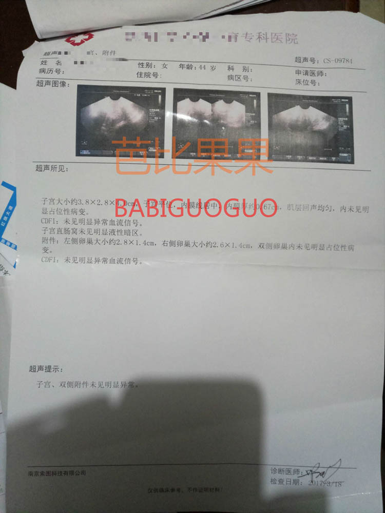 卵巢功能衰退,想选性别