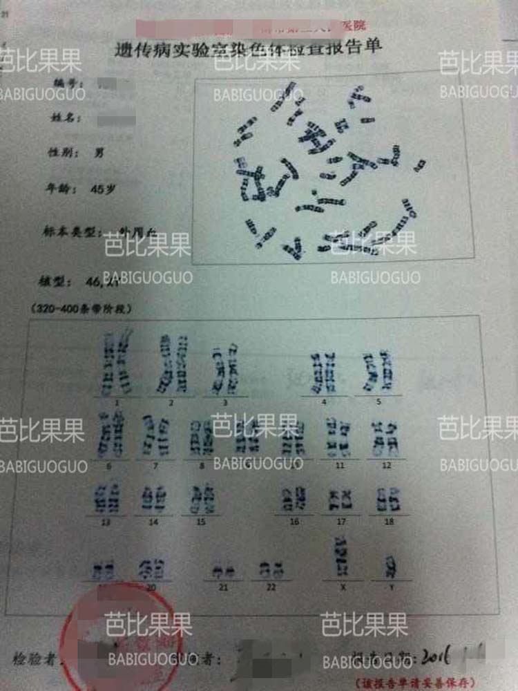 女方50岁自卵促排条件没通过 乌克兰试管孕育成功