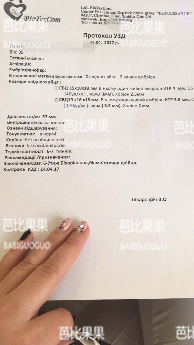 乌克兰试管DY检验报告