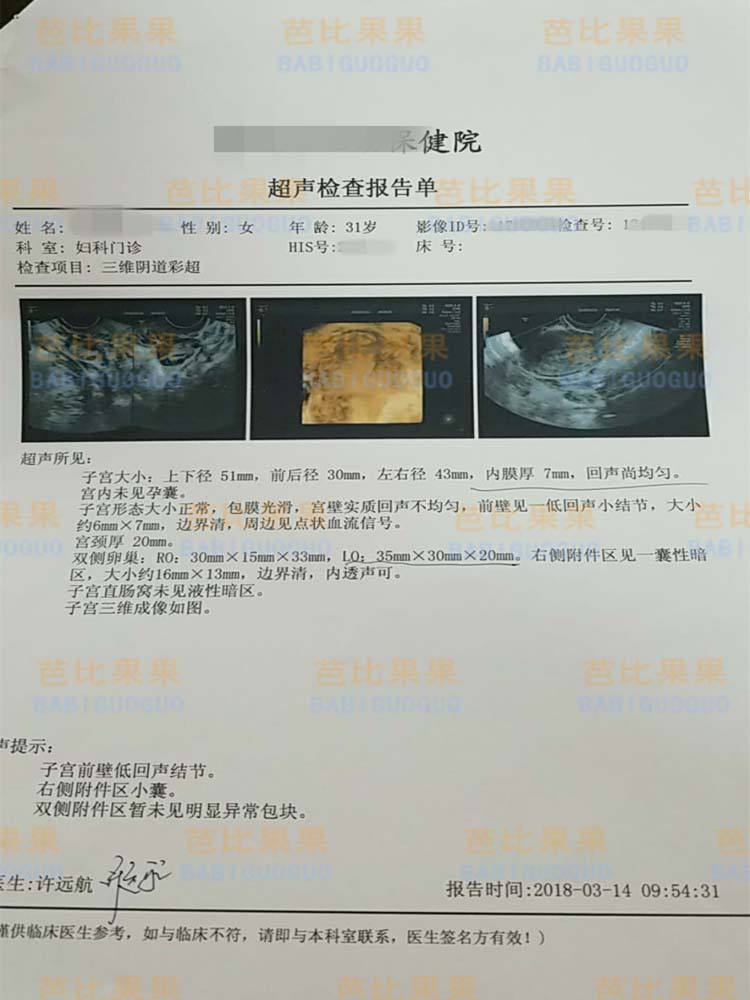 31岁排卵异常2次试管失败走向泰国试管之路成功怀孕