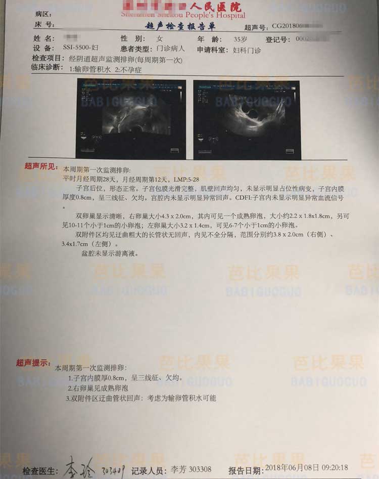 女方检验报告