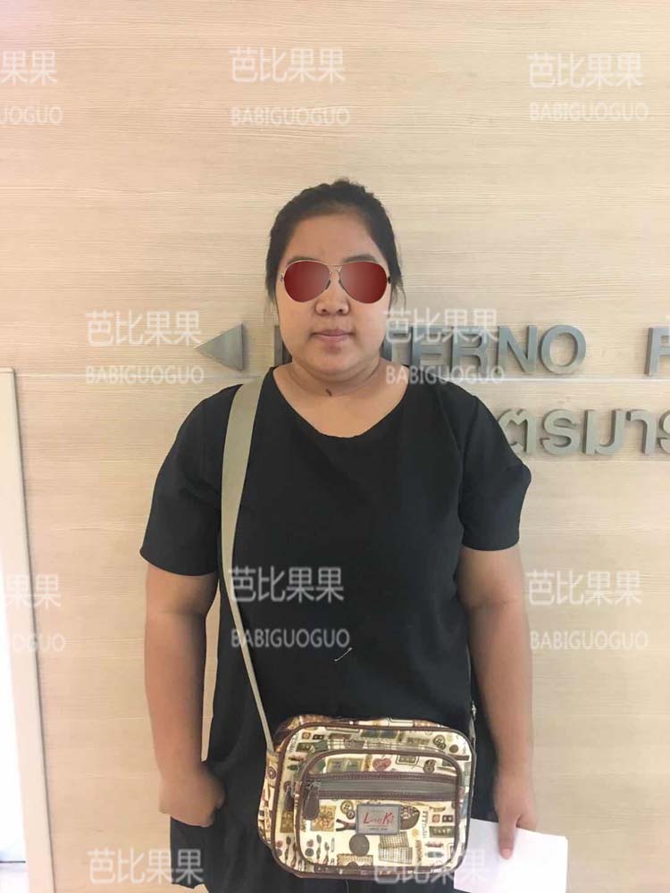 泰国试管婴儿 单身