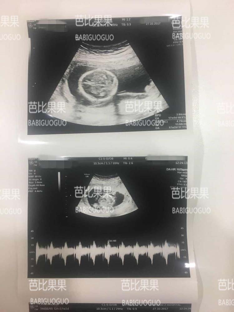 泰国试管婴儿 单身