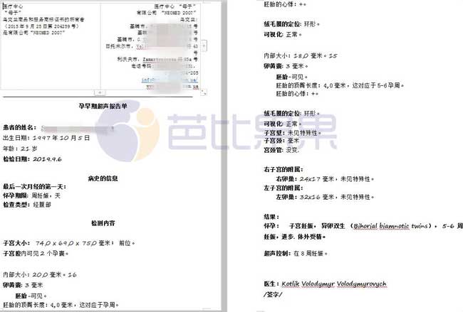 第四次移植首次B超报告