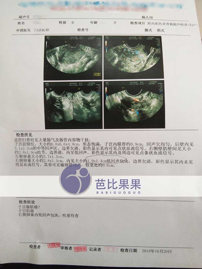 N女士子宫检查报告