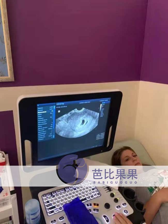 乌克兰代妈B超报告