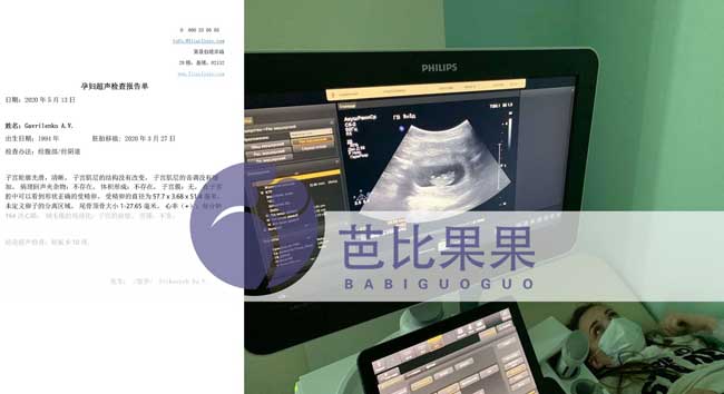 乌克兰代妈第二次B超报告