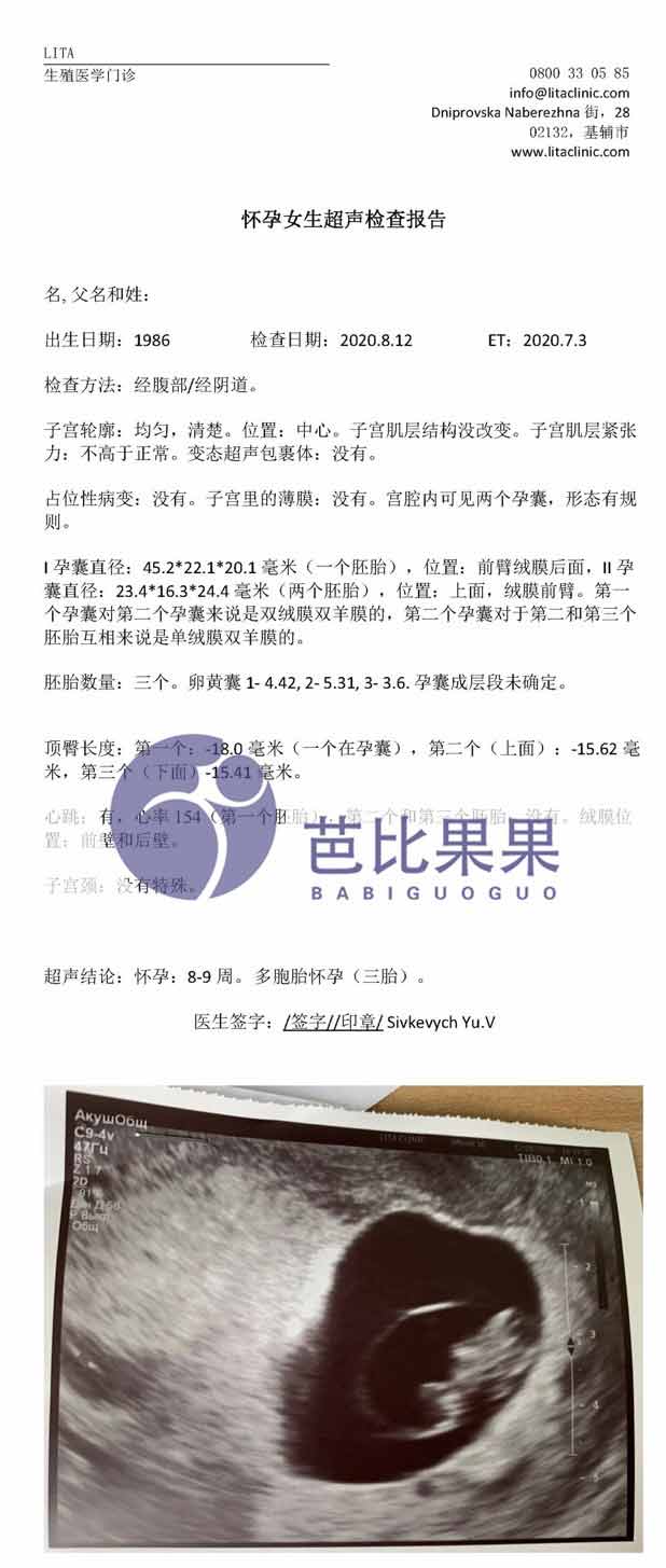 乌克兰代妈第一次B超报告