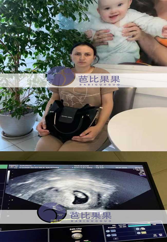 乌克兰代妈做B超