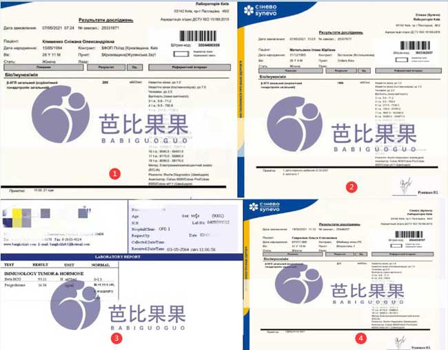 乌克兰试管验孕成功报告