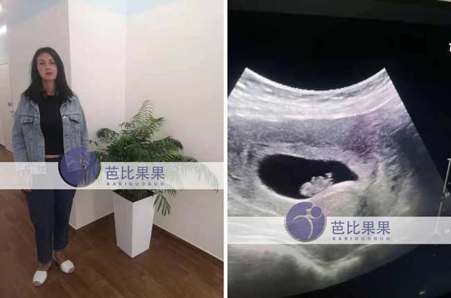 孕妈第二次B超报告