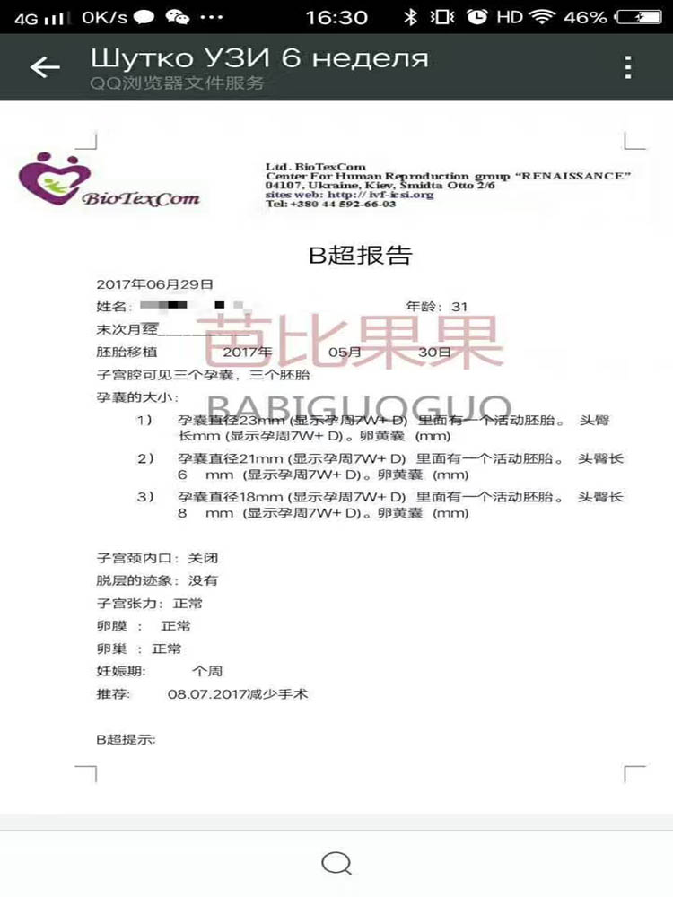 乌克兰试管分享