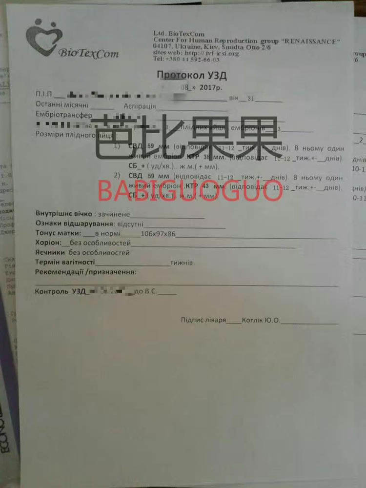 乌克兰试管B超