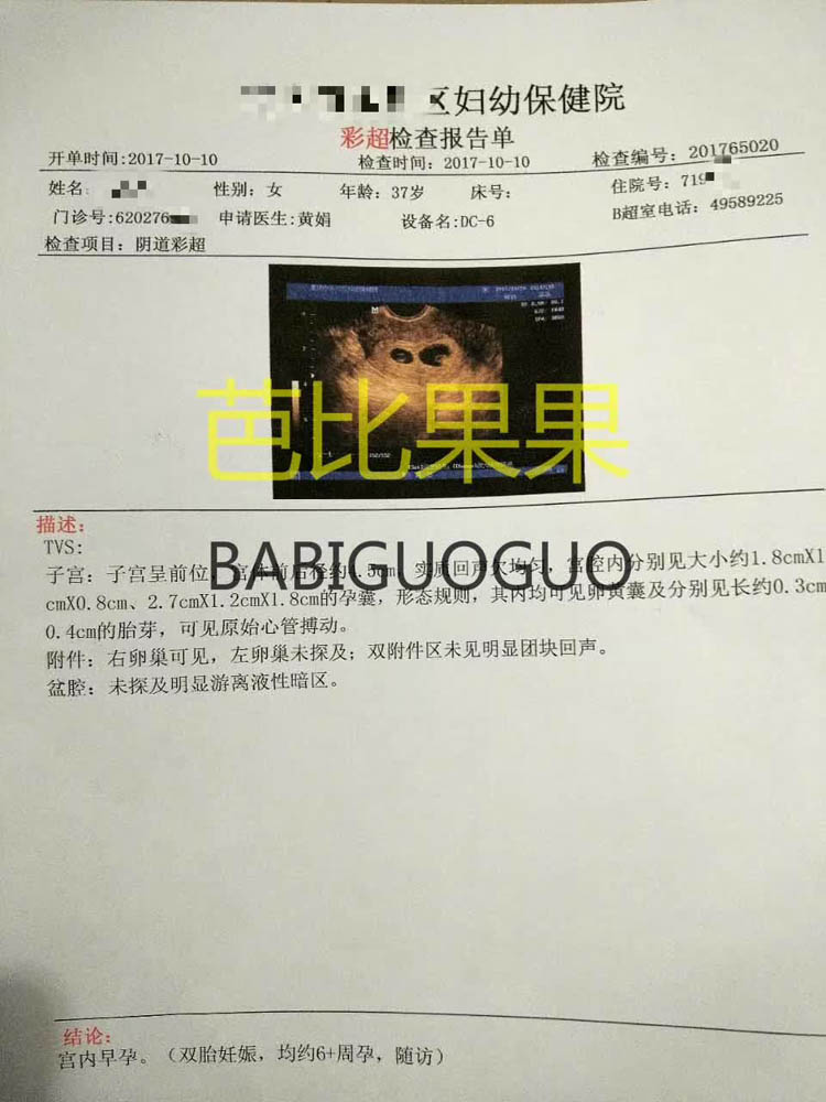 泰国威它尼医院通过OD试管 成功怀上双胞胎男孩