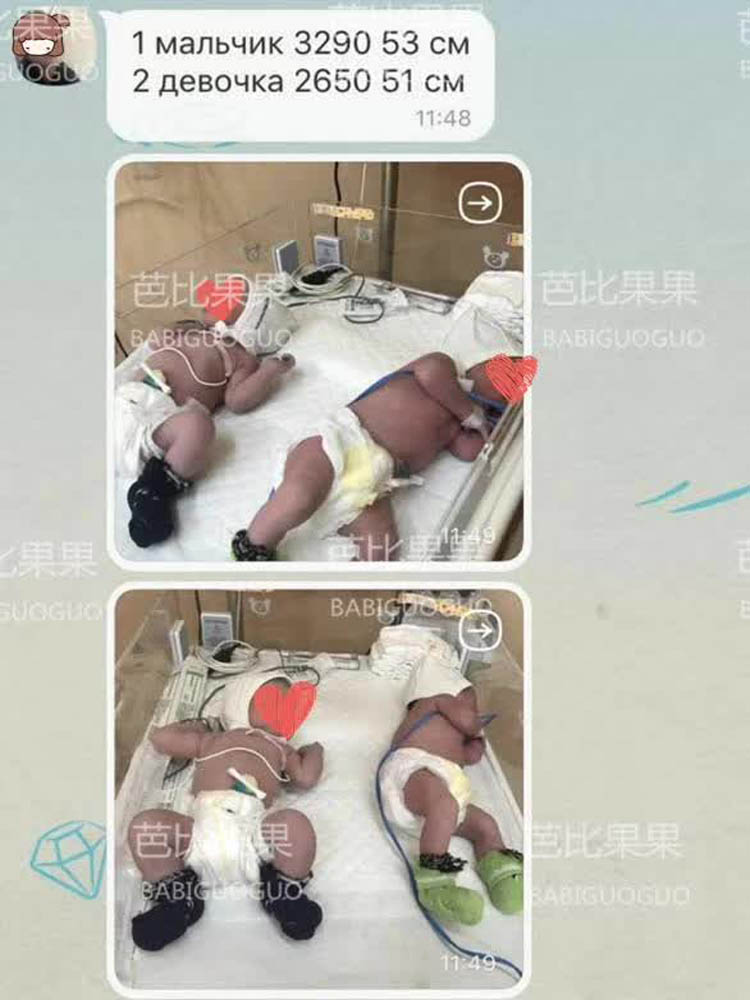 福建M姐的龙凤胎在乌克兰基辅足月健康出生