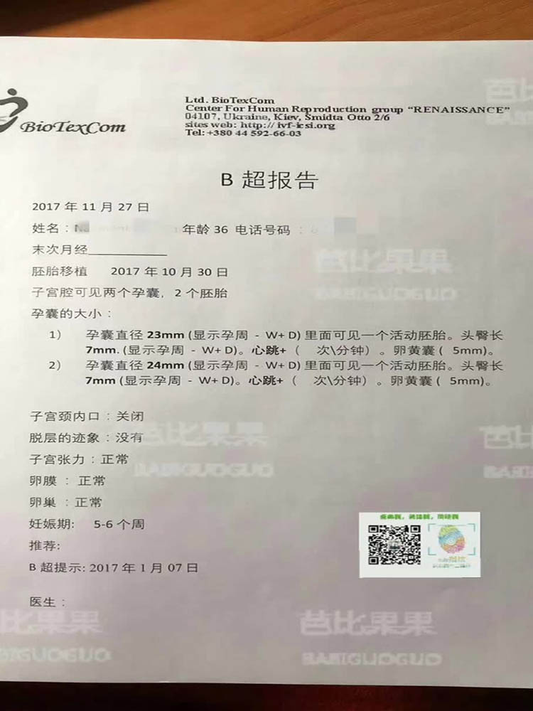 W夫妻DY试管的第一次B超  果然是双胞胎