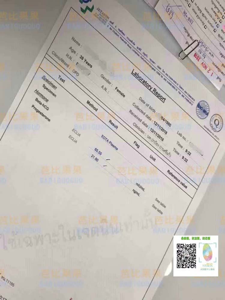 W姐姐历经了两次促排在泰国jetanin医院试管验孕成功
