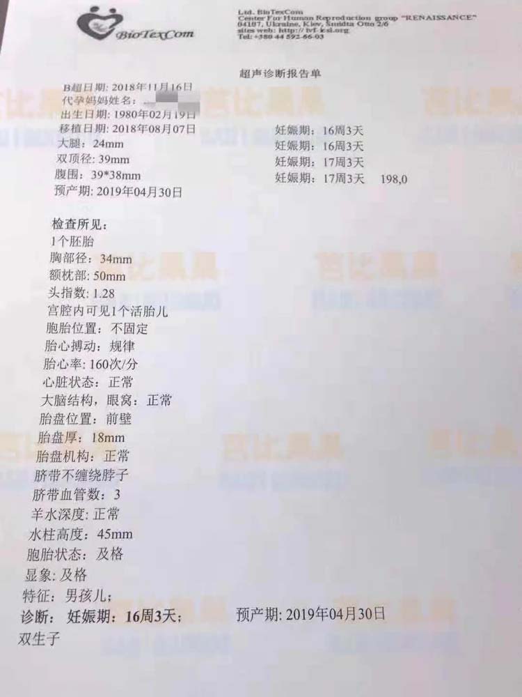 Z女士的乌克兰爱心妈妈孕16周B超 惊喜得龙凤胎