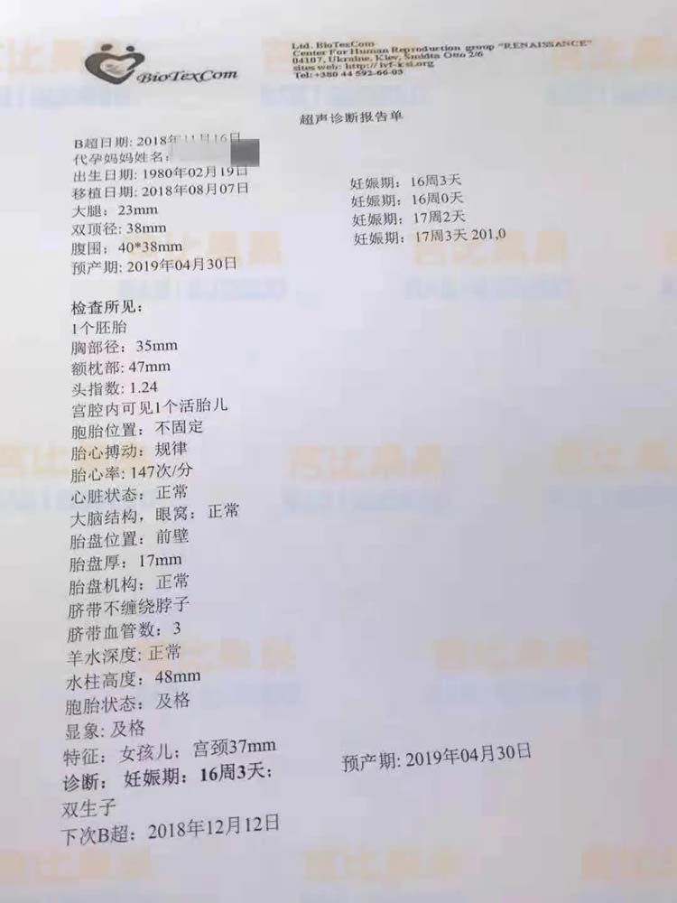 乌克兰孕妈龙凤胎