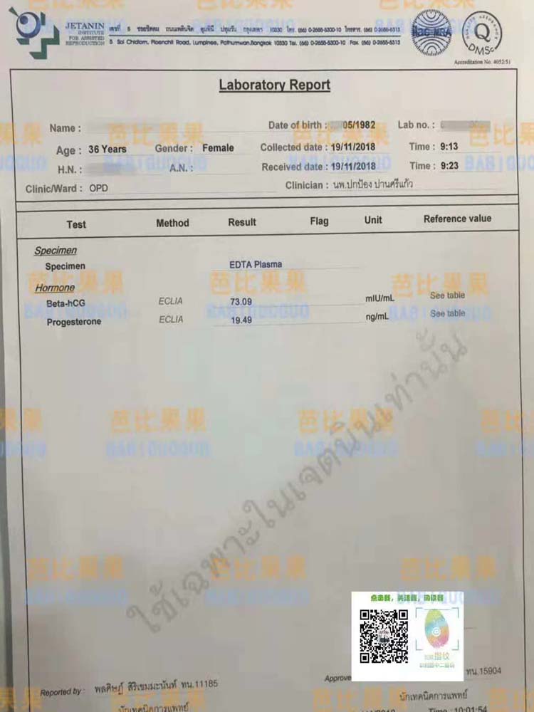 广东36岁H姐在杰特宁试管婴儿医院验孕喜得女宝