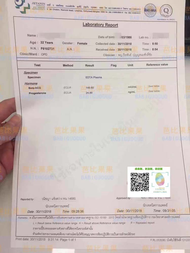 云南T小姐在泰国jetanin做试管抽血验孕一次成功