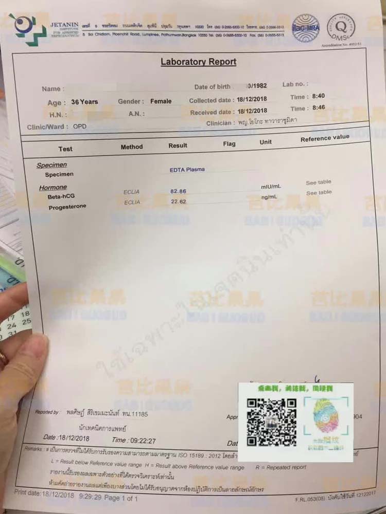 浙江C姐想要男孩在杰特宁医院做三代试管验孕成功