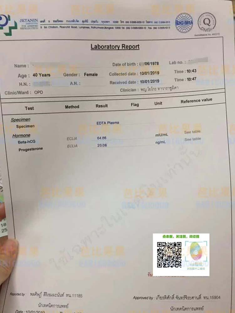 广东X姐年龄偏高 第三次移植终于验孕成功