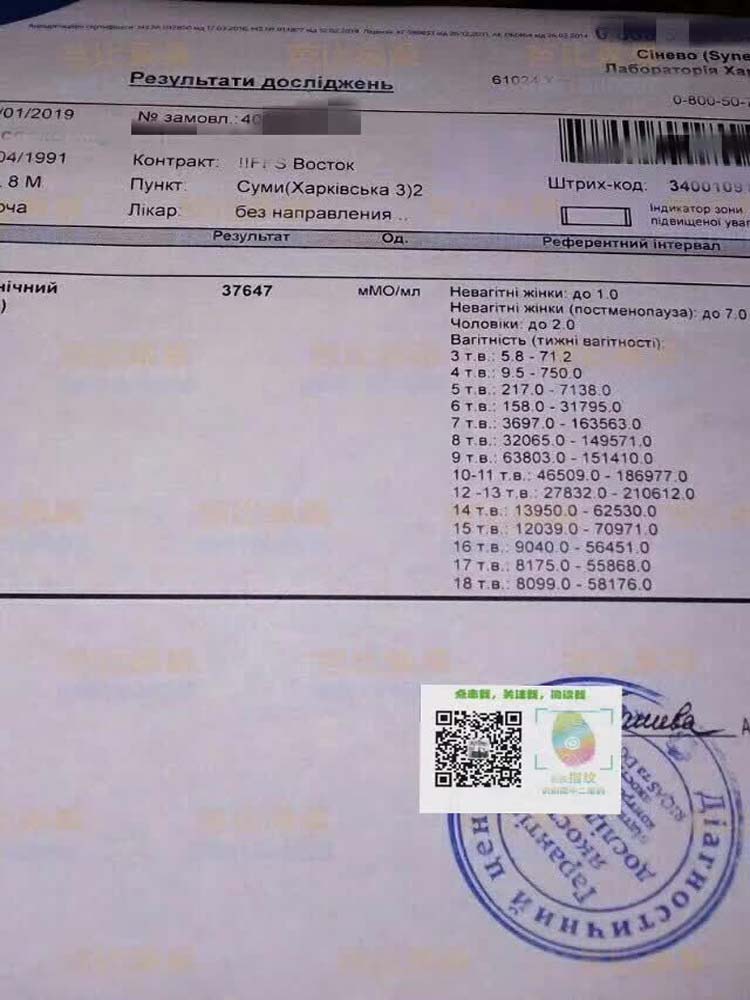 乌克兰百奥医院爱心妈妈的验孕报告 HCG值高