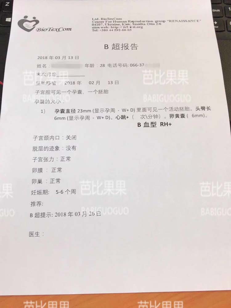F女士自卵SGM 爱心妈妈一次移植确认着床成功